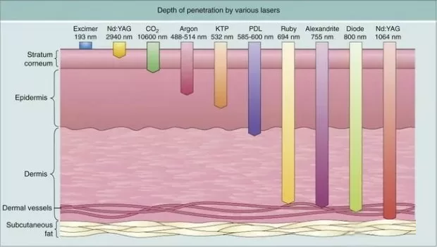 Depth of penetration by various lasers