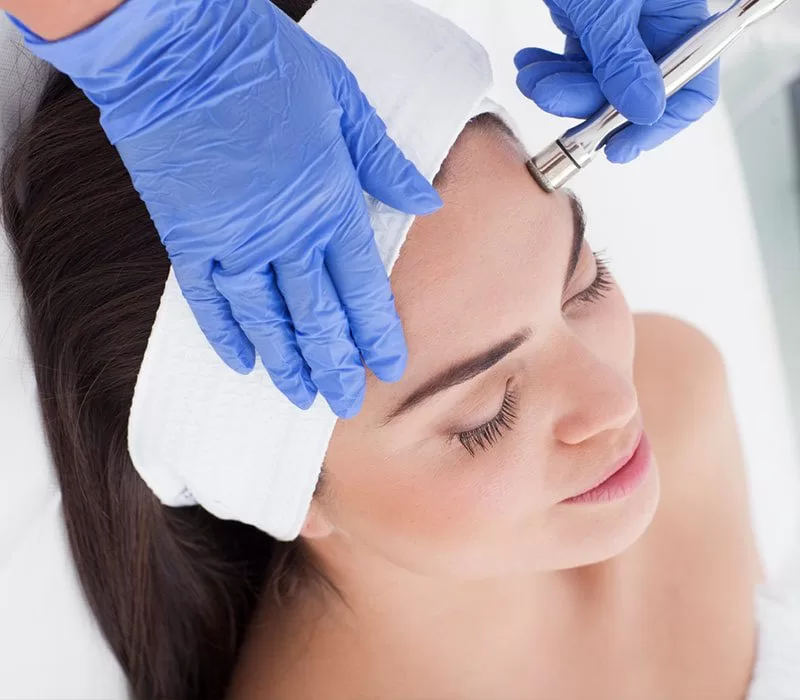 Microdermabrasion treatment on forehead