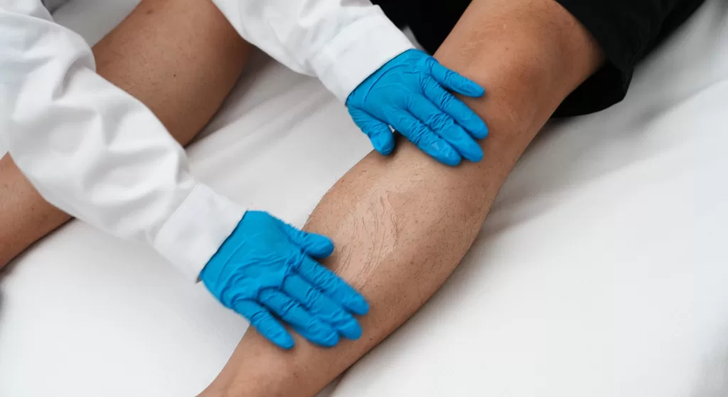 apply cream or gel during cavitation treatment on legs