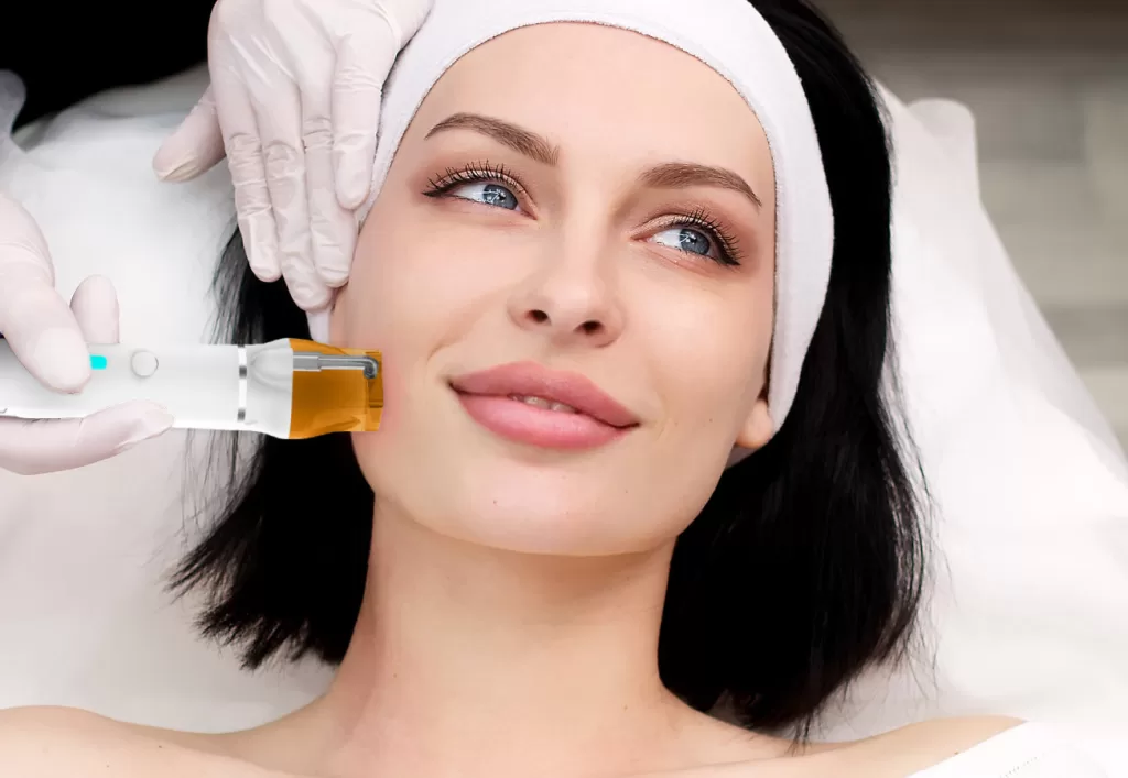 microneedling facial therapy