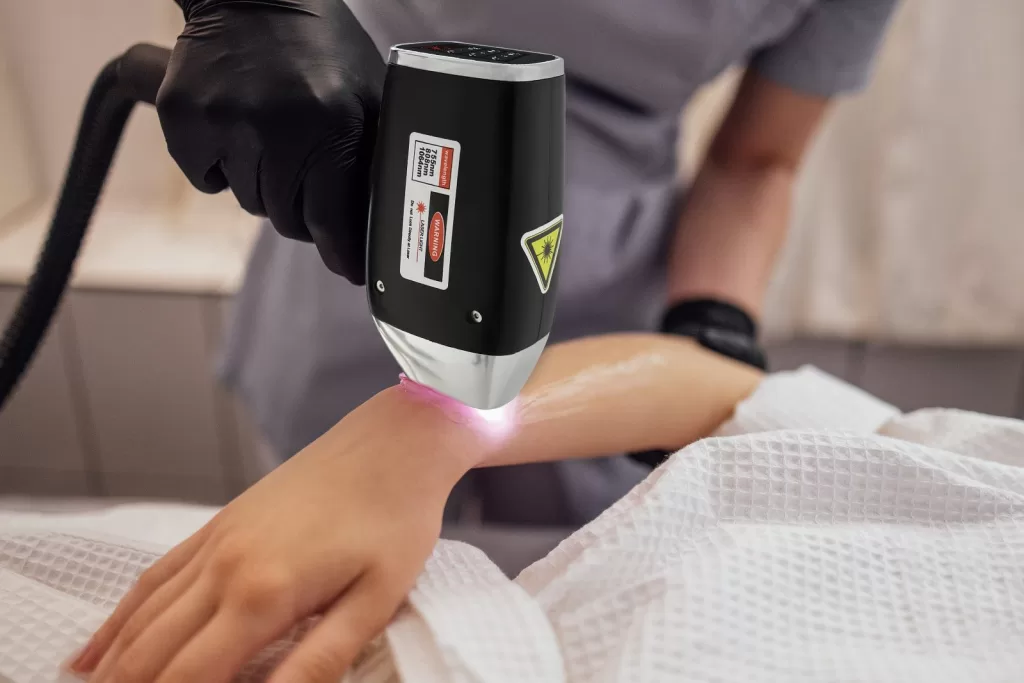 diode laser hair removal handpiece on the arm and hand