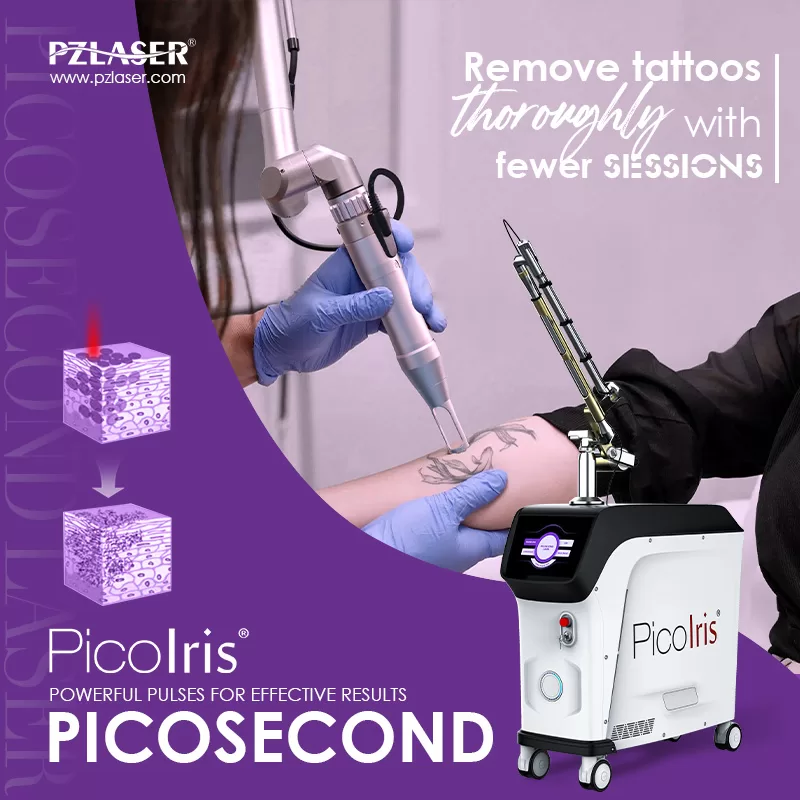 PicoIris® picossecond tattoo removal machine