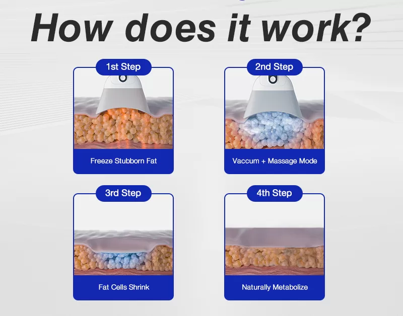 What’s special about #CoolSlimming™ work?