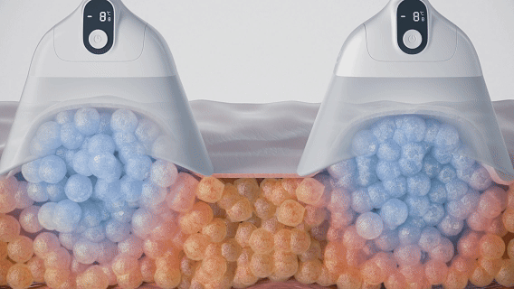 CoolSculpting 3D animation demonstration