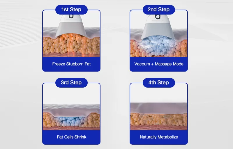A sub-zero device fat freezing system uses applicators to gently suction the skin and underlying fat into a treatment cup. This ensures maximum contact with the cooling plates.