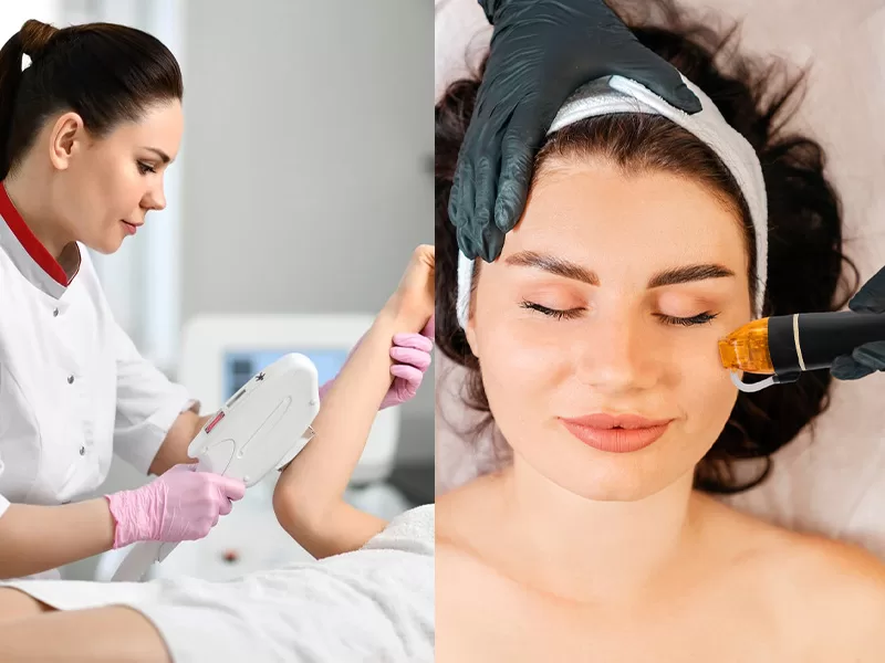 RF Microneedling and DPL + NIR—are also gaining popularity in professional skincare.
