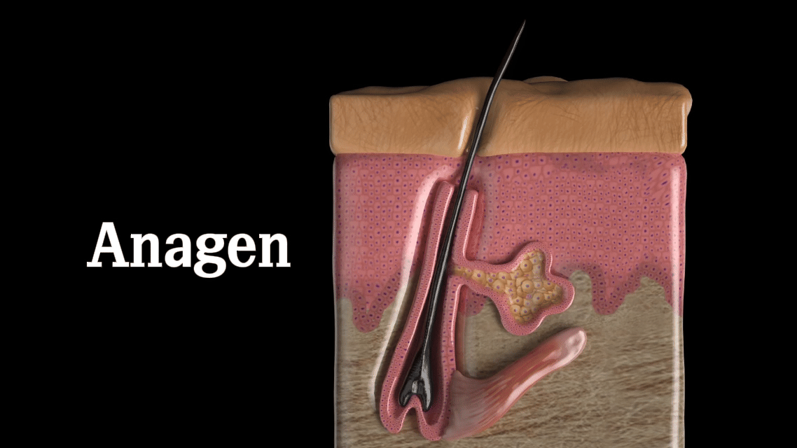 Laser-induced thermal injury must reach the bulge region and dermal papilla to ensure permanent reduction. Only anagen follicles are physiologically connected to these structures.