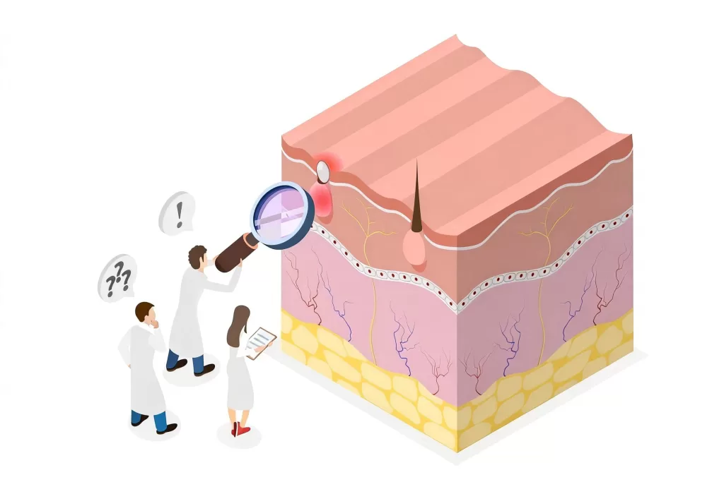 Get rid of acne scars is not just a cosmetic service, but a high-demand medical aesthetic solution, restoring confidence and delivering long-term clinical results.