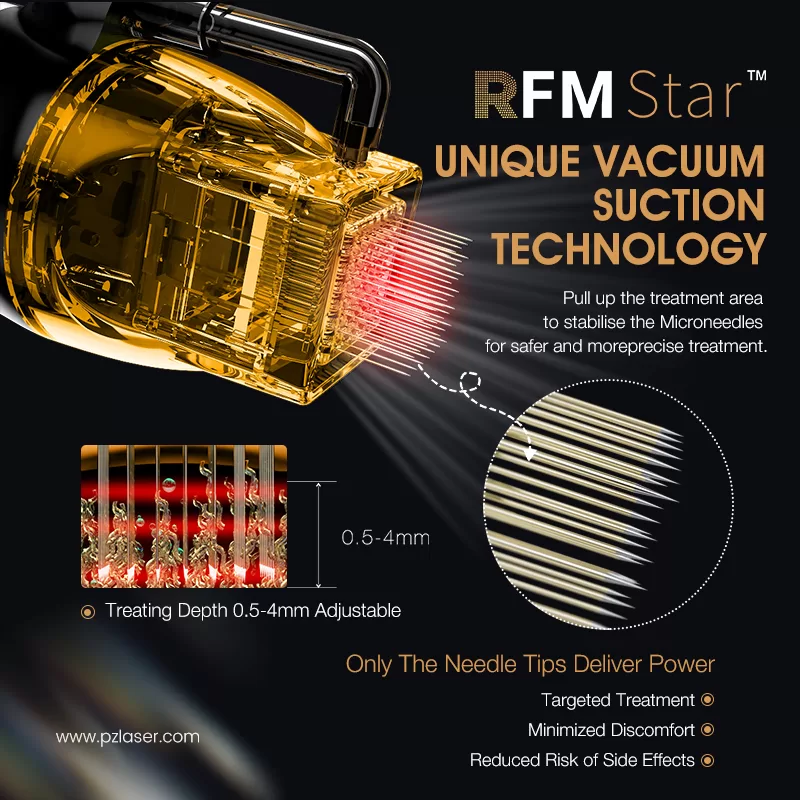 RFMStar™: Multiple Advantages In One