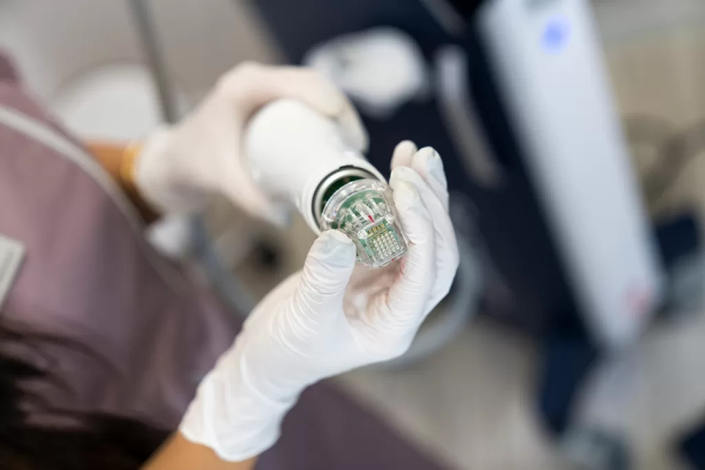 What Does RF Microneedling Feel Like During Treatment?