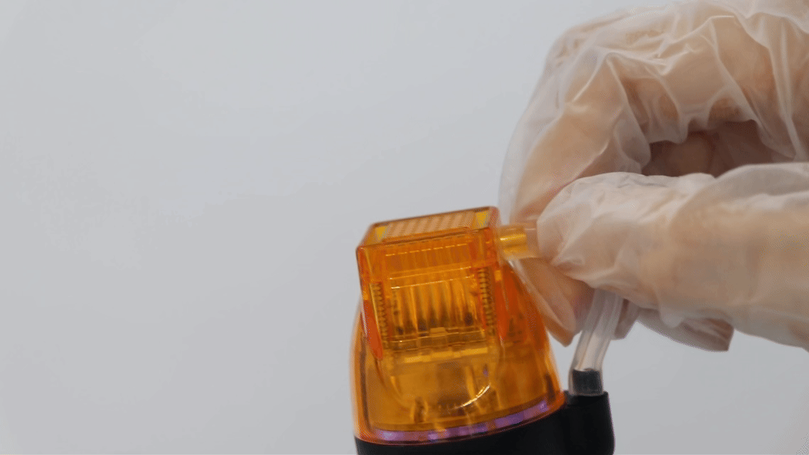 Does RF Microneedling Hurt?