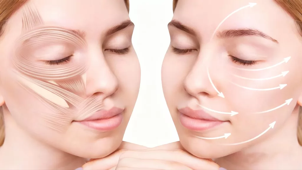 The SMAS Facelift is widely regarded as the gold standard for correcting deeper signs of facial aging, because it targets the Superficial Musculoaponeurotic System.