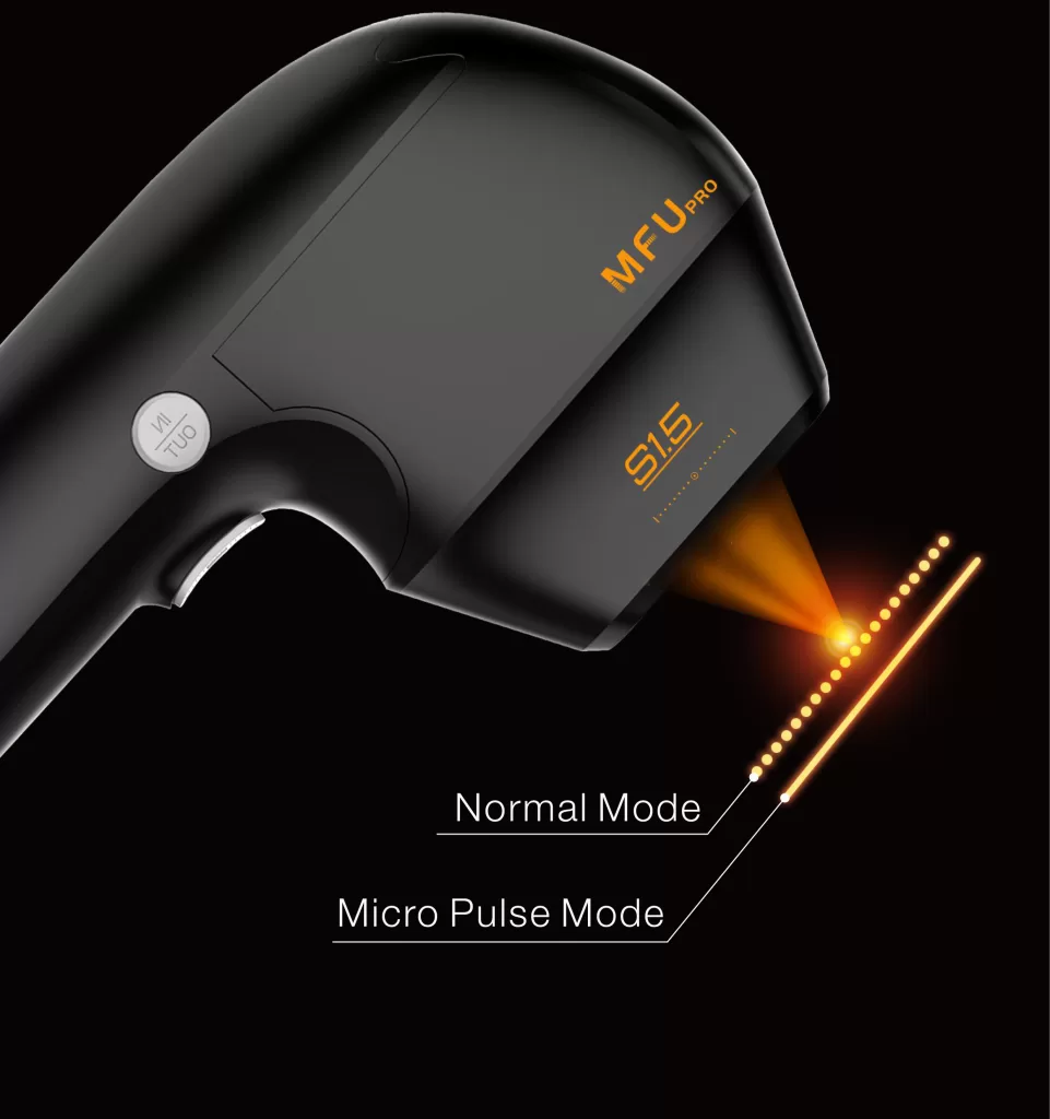 Customized treatment depending on the skin type, treatment, and depth of dermis to the subcutaneous tissue fat layer.