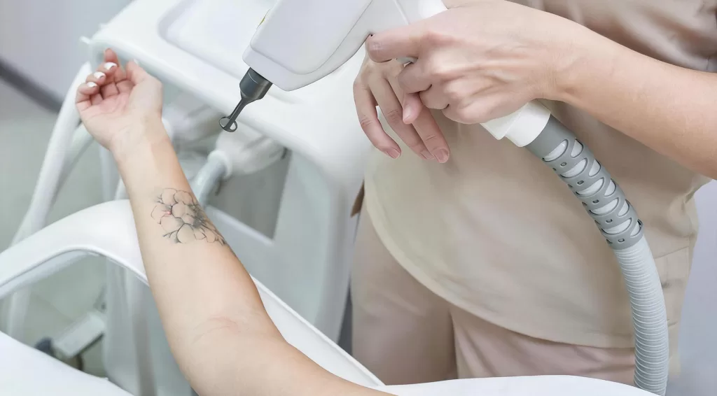 Multi-Color Tattoo Removal Laser systems increasingly combine multiple wavelengths + picosecond technology.