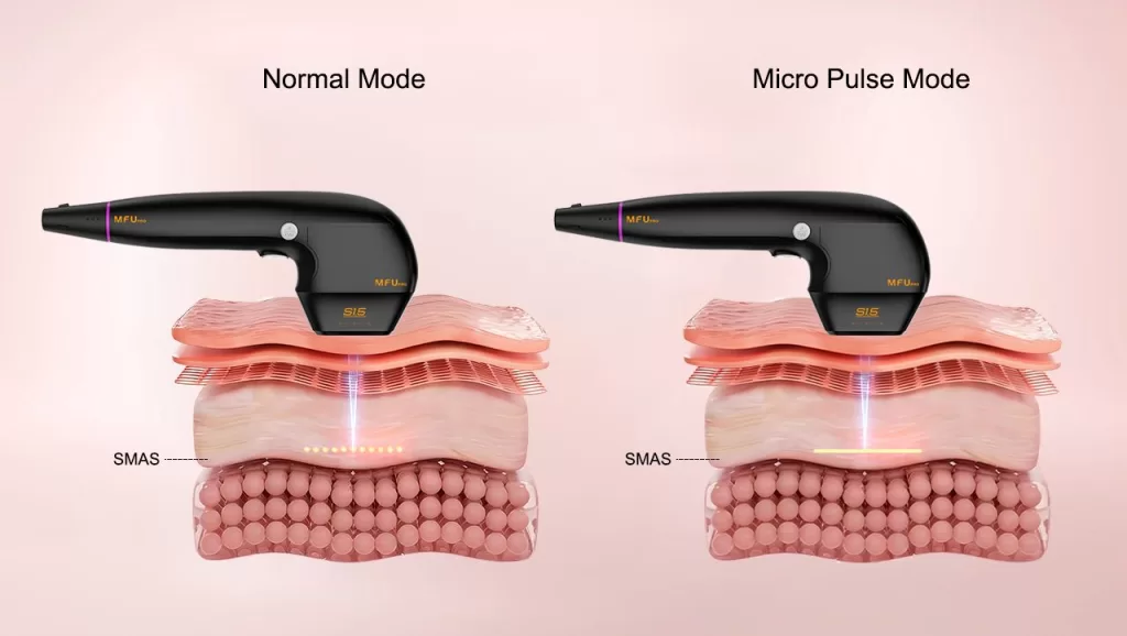 PZLASER upgraded the MFUPRO system, integrating MPT into a platform designed for today’s needs.