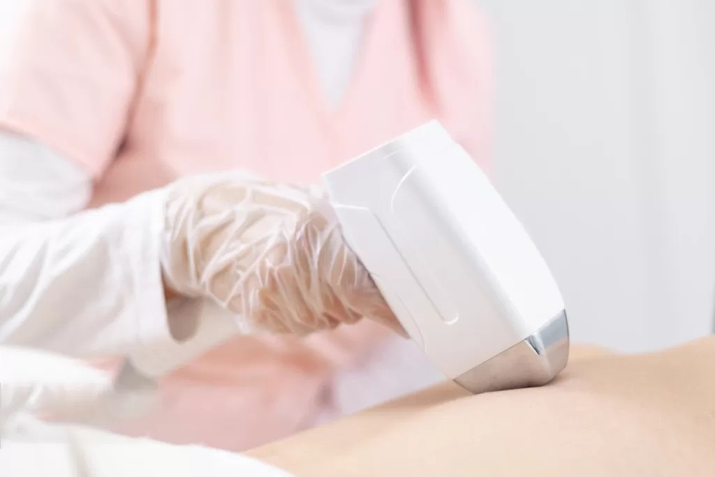 4 wavelength diode laser hair removal systems