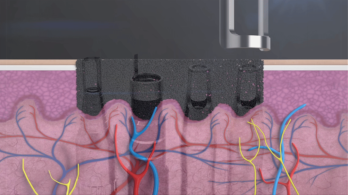 3D Demonstration of Picosecond Laser Principles